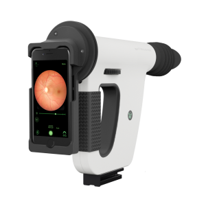 remedio-fundus-camera-300x300 remedio-fundus-camera-300x300